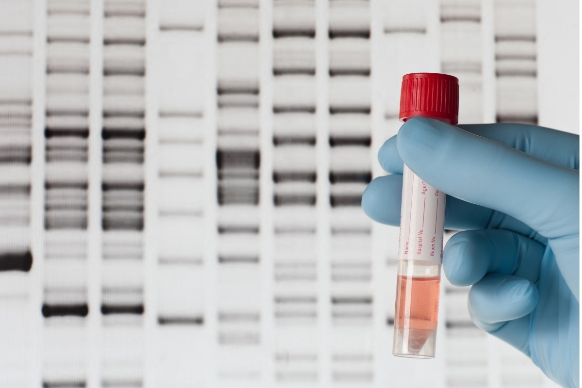 test genetic WES pret